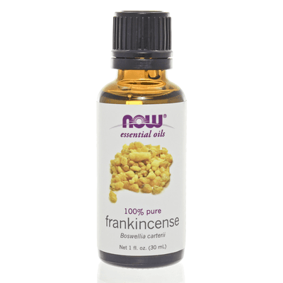 Frankincense Oil 100% Pure (1 Ounce)