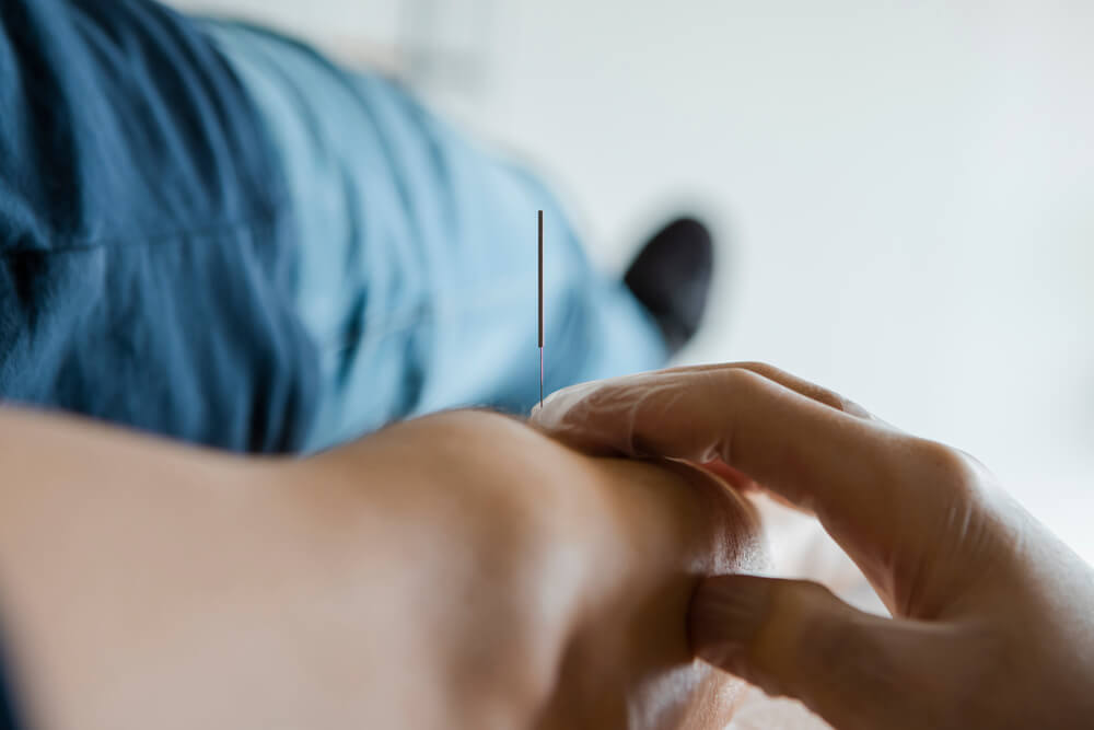 person receiving acupunture treatment
